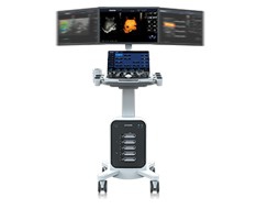 Chison SonoMax Ultrasound Machines Chison SonoMax Ultrasound Machines